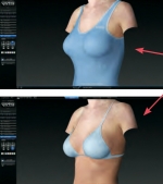 3D-моделировние для пациентов доктора Свиридова