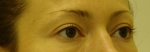 До