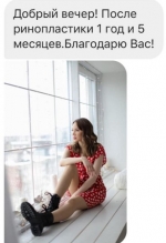 Ринопластика. Стайсупов. Отзывы