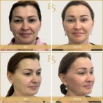 Светлана Пшонкина. Визаж Лифт