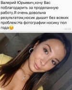 Ринопластика. Стайсупов. Отзывы