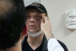Рома Жуков сделал пластику у Гайка Бабаяна