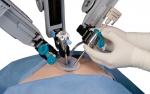 Da Vinci Surgical System 